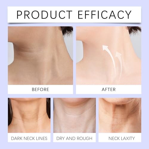 Ginaday Tighten and Lift Neck Cream, Moisturizing Pro-Active Repair Neck Firming and Tightening Anti Aging Neck Tightening Cream. (1 Pcs)