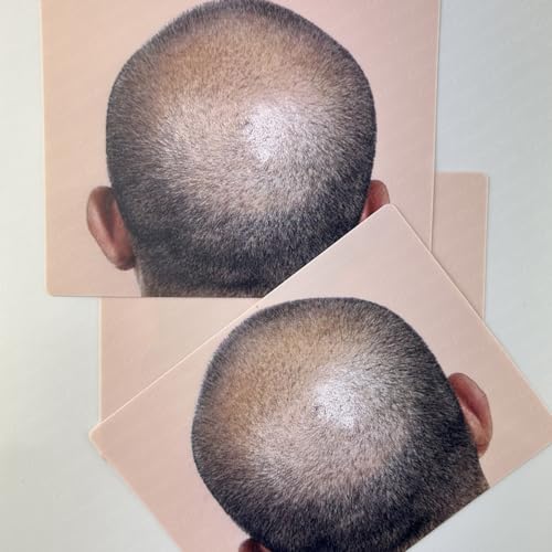 Guapa Scalp Micropigmentation Practice Skin Bald Scalp Practice Sheet Realistic Hair Tattoo Training for SMP Artists (Bald Pattern 1pc)