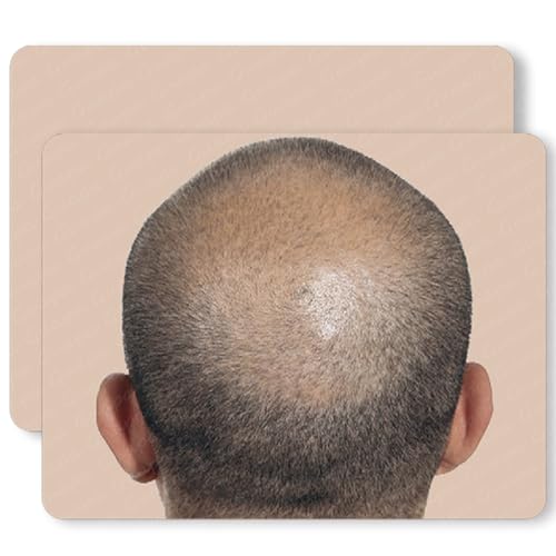 Guapa Scalp Micropigmentation Practice Skin Bald Scalp Practice Sheet Realistic Hair Tattoo Training for SMP Artists (Bald Pattern 1pc)