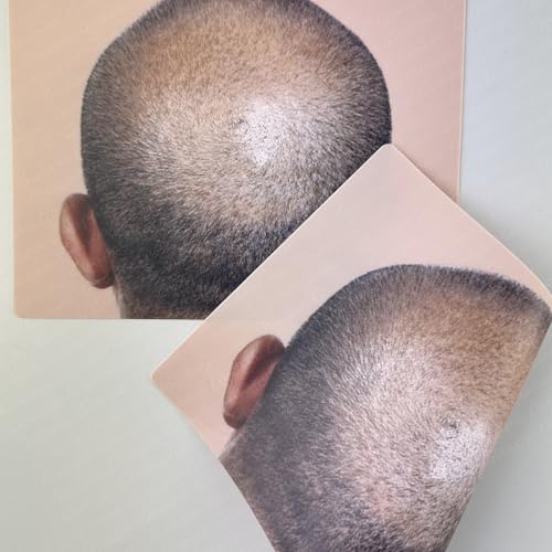 Guapa Scalp Micropigmentation Practice Skin Bald Scalp Practice Sheet Realistic Hair Tattoo Training for SMP Artists (Bald Pattern 1pc)