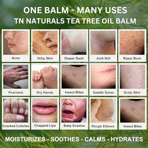 TEA TREE OIL BALM | All Natural Help for Acne, Moisturizer, Soothing Relief for Many Skin Conditions | Skincare for Tattoos, Dry, Itchy Skin, Irritations, Eczema (2.12 Ounce (Pack of 1))