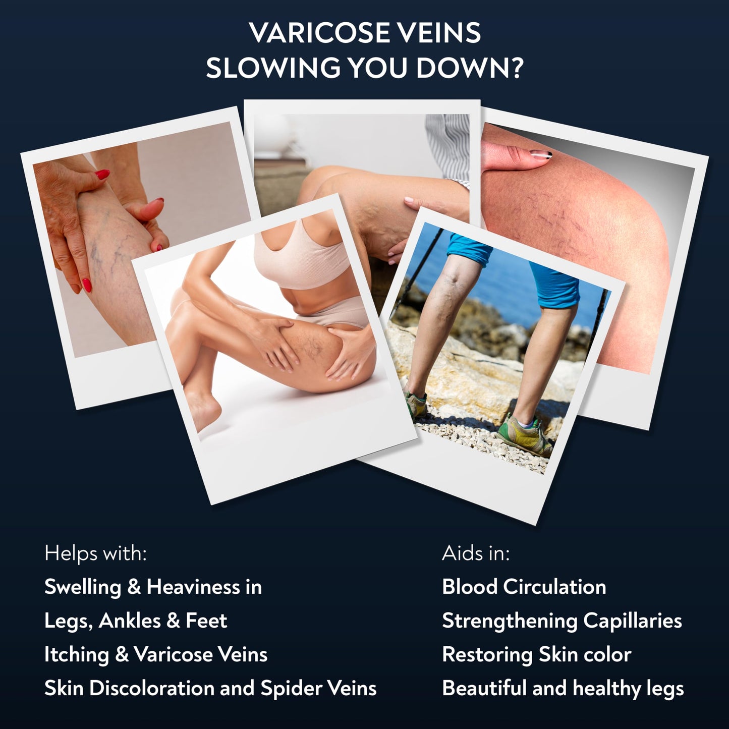 PENIKOSETE Varicose Veins Treatment | Natural Ayurvedic Cream for Legs with Ashwagandha | Spider Vein Removal Cream for Improved Circulation & Relief from Heavy Fatigued Legs | Non-Sticky