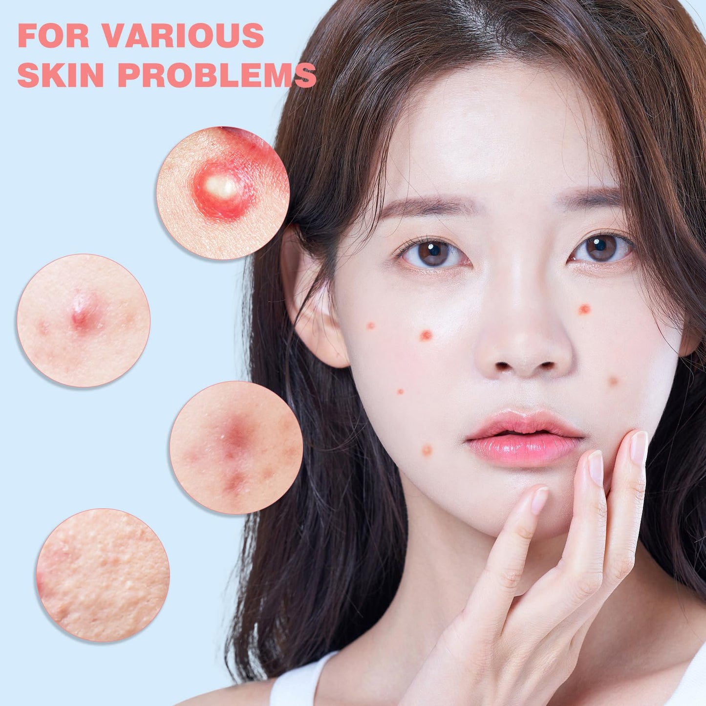 HLOES Pimple Patches for Face 280PCS, Hydrocolloid Acne Patches for Covering Zits and Blemishes, Cute Star Pimple Patches, Facial Skin Care Products.